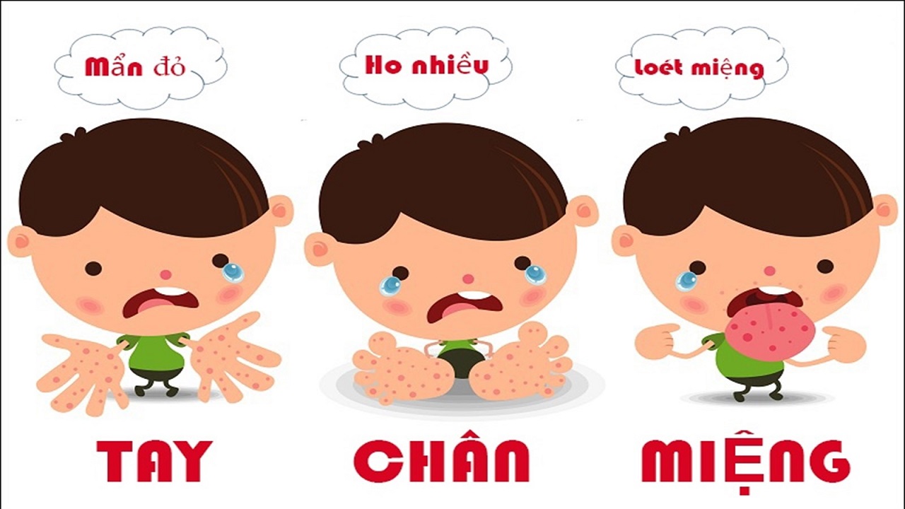 Phòng bệnh Tay chân miệng cho trẻ